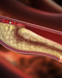 Holesterol i kardioprotektivi