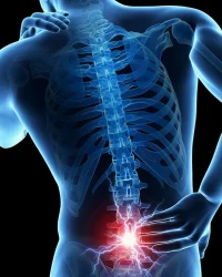 Bol u leđima i mišićima